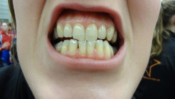 Ik ben niet bang voor de tandarts, want ik heb zo goed gepoetst, met Colgate bi-fluor