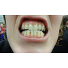 Ik ben niet bang voor de tandarts, want ik heb zo goed gepoetst, met Colgate bi-fluor