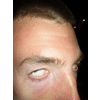 Boy zonder bril
